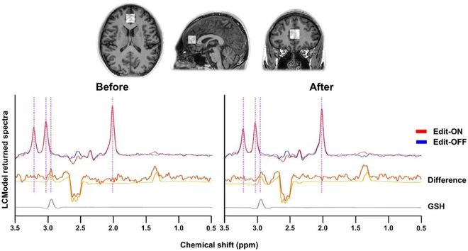 能改善你的记忆力？为什么嚼嚼木头就(图5)